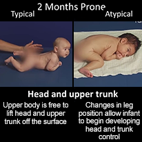 Load image into Gallery viewer, Recognizing Early Motor Delays at 2, 4, 6 Months of Age and Importance of Tummy Time